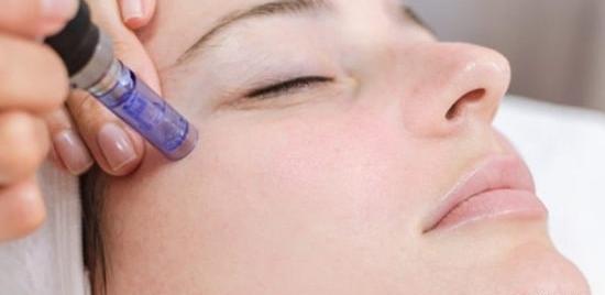 عکس های قبل و بعد مزونیدلینگ