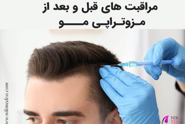 عکس های قبل و بعد مزوتراپی صورت