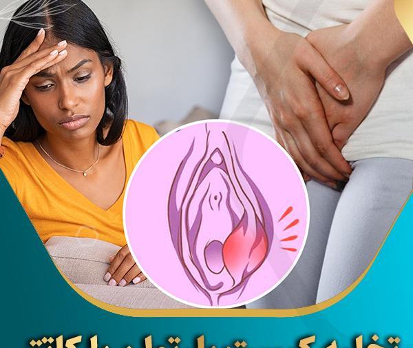 تخليه كيست عکس واقعی کیست بارتولن