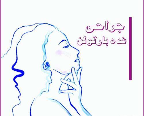 تخليه كيست عکس واقعی کیست بارتولن