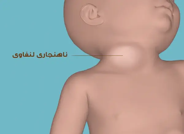 عکس واقعی غدد لنفاوی کشاله ران در مردان