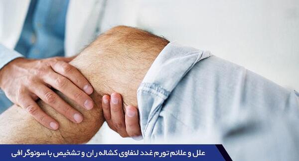 عکس واقعی غدد لنفاوی کشاله ران در مردان