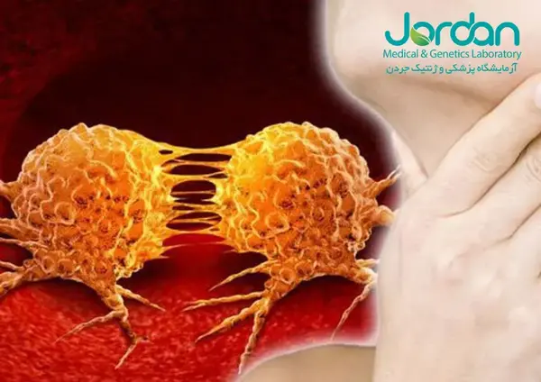 سرطآن لنفوم عکس واقعی غدد لنفاوی کشاله ران