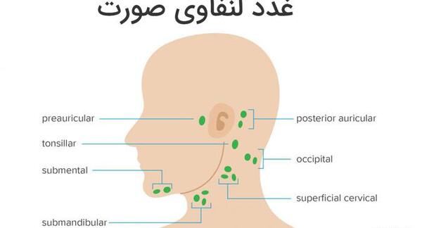 سرطآن لنفوم عکس واقعی غدد لنفاوی کشاله ران