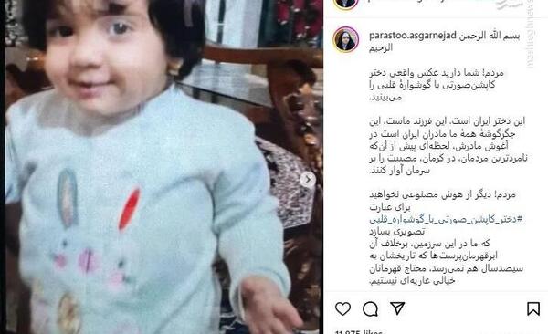 عکس واقعی کاپشن صورتی گوشواره قلبی
