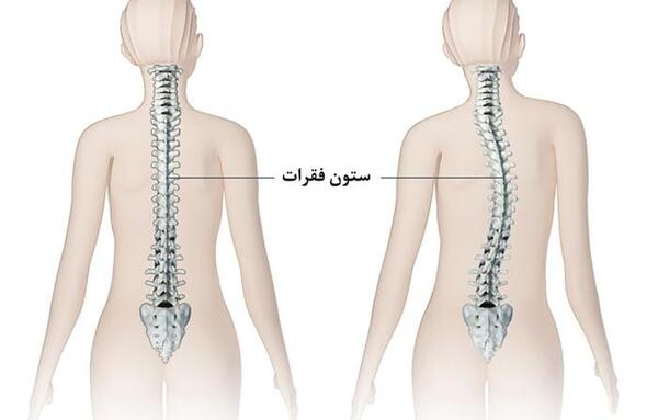 عکس واقعی ستون فقرات انسان