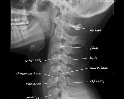 عکس واقعی ستون فقرات انسان