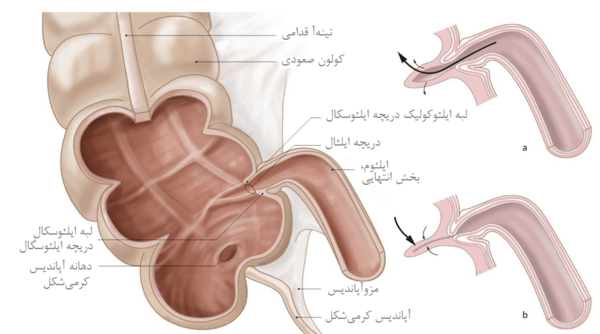 عکس واقعی روده بزرگ انسان