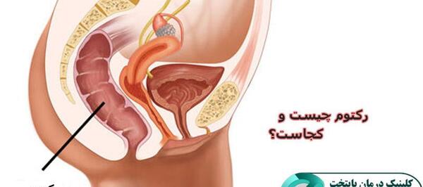 عکس واقعی روده بزرگ انسان