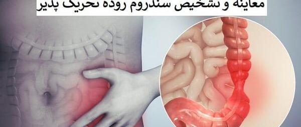 عکس واقعی روده بزرگ انسان