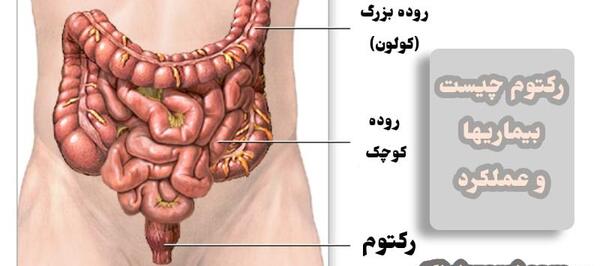 عکس واقعی روده بزرگ انسان