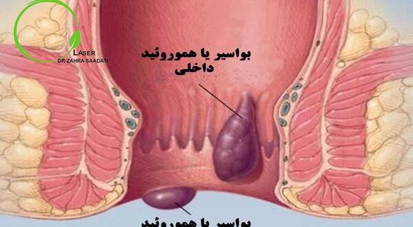 عکس روده ی واقعی انسان