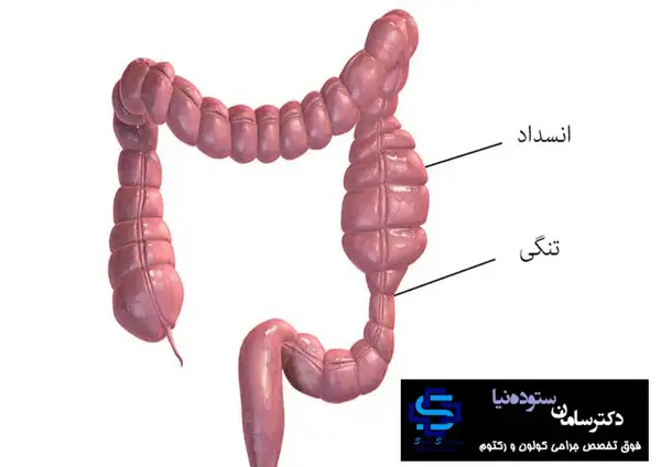 عکس روده ی واقعی انسان