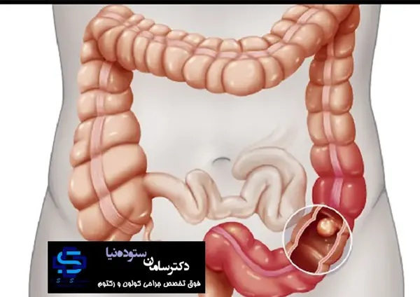 عکس روده ی واقعی انسان