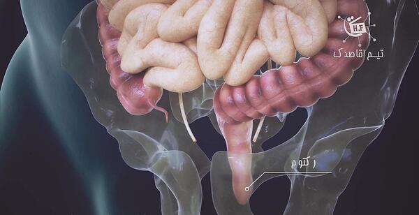 عکس روده ی واقعی انسان