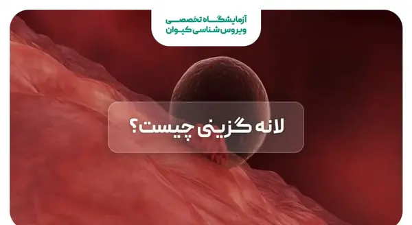 لقاح عکس واقعی خونریزی لانه گزینی