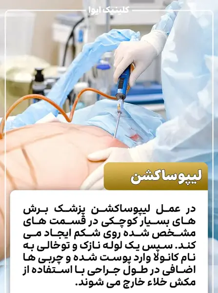 جراحی عکس واقعی چربی شکم