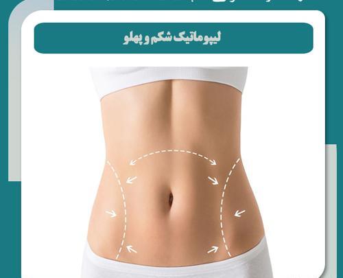 جراحی عکس واقعی چربی شکم