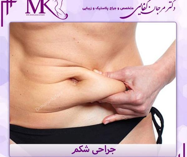 جراحی عکس واقعی چربی شکم