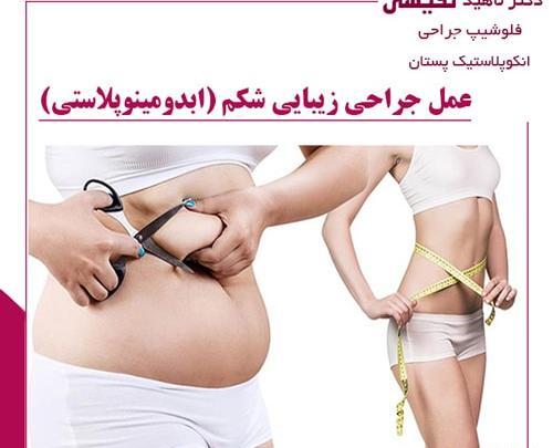 جراحی عکس واقعی چربی شکم