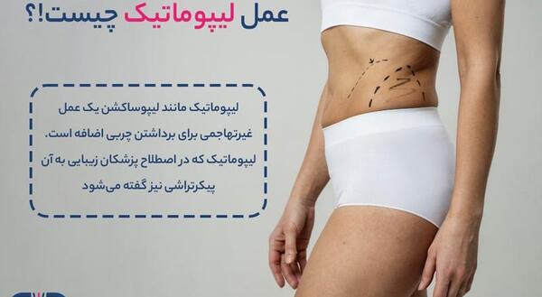 جراحی عکس واقعی چربی شکم