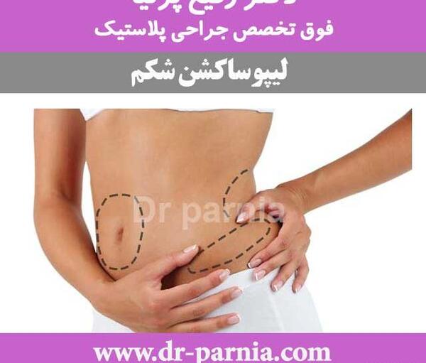 جراحی عکس واقعی چربی شکم