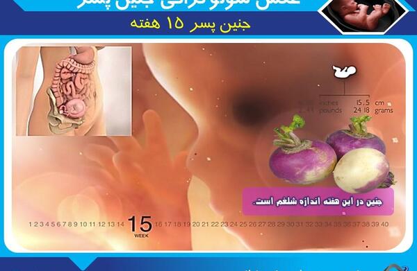 عکس واقعی جنین 20 هفته پسر