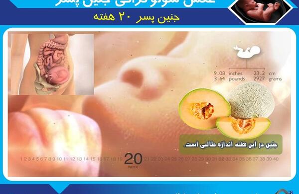 عکس واقعی جنین 20 هفته پسر