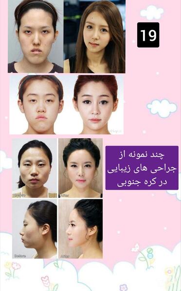 عکس واقعی بی تی اس بدون آرایش