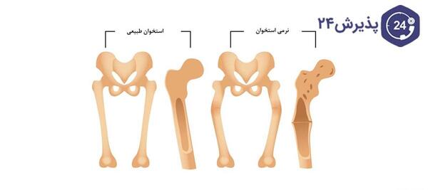 عکس اسکلت کوچک برای ادیت