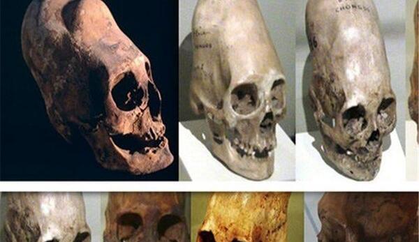 عکس اسکلت نادر شاه
