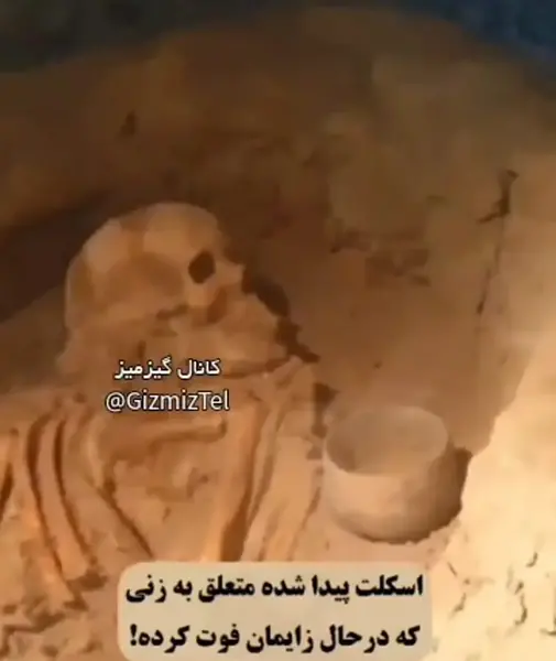 عکس اسکلت زن باردار