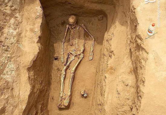 عکس اسکلت زنده واقعی