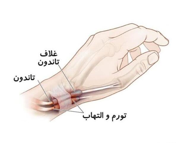 عکس اسکلت دست راست انسان