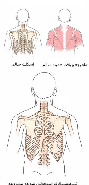 عکس اسکلت بدن انسان با چوب کبریت