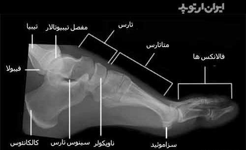 عکس اسکلت پاشنه پا