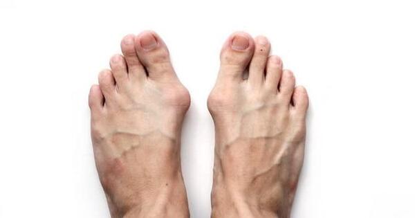 عکس اسکلت پاشنه پا
