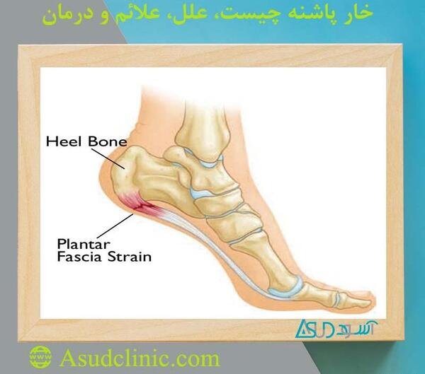 عکس اسکلت پاشنه پا