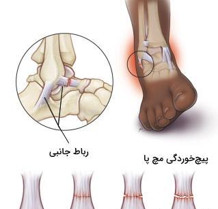 عکس اسکلت پای سالم