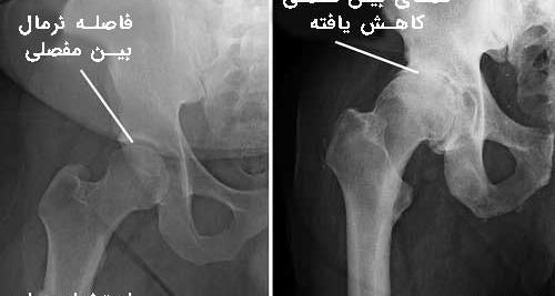 عکس اسکلت پای سالم
