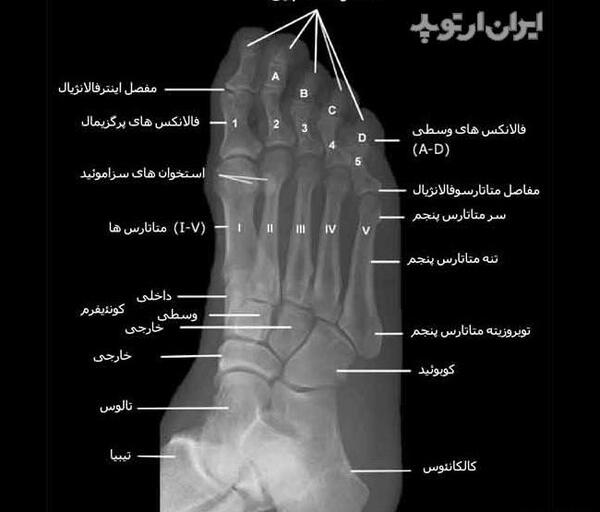عکس اسکلت پای سالم