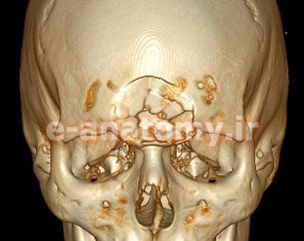 عکس اسکلت چشم ضربدری