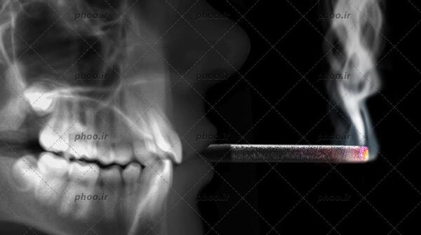 عکس اسکلت با پس زمینه مشکی