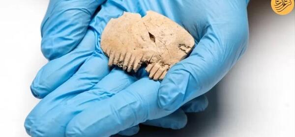 عکس اسکلت بدن با گوش پاک کن