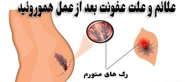 کیا بعد عکس رنگی عفونت گرفتن نی نی سایت