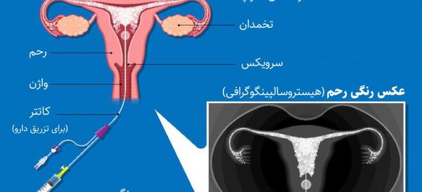 کیا با وجود عفونت عکس رنگی گرفتن نی نی سایت
