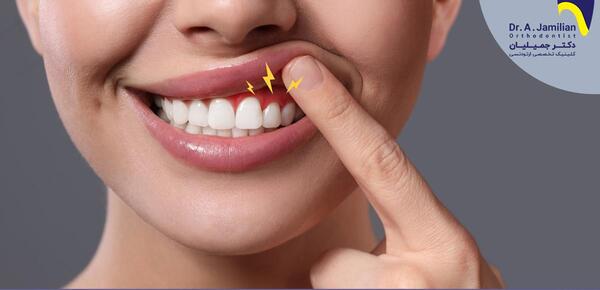 کیا با وجود عفونت عکس رنگی گرفتن نی نی سایت