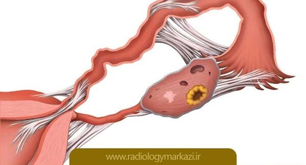 کیا با وجود عفونت عکس رنگی گرفتن نی نی سایت