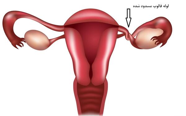 کیا ماهی ک عکس رنگی گرفتن باردار شدن نی نی سایت