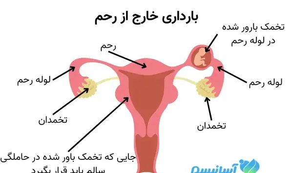 کیا ماهی که عکس رنگی گرفتن باردار شدن